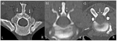 Comparison of standard T2-weighted turbo spin echo and volumetric interpolated breath-hold examination magnetic resonance imaging sequences in the assessment of articular process dysplasia in Pug dogs with thoracolumbar myelopathy